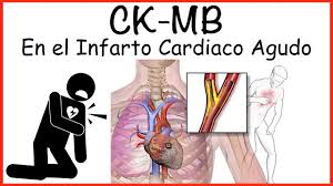 ck mb uso en ino cardiaco you
