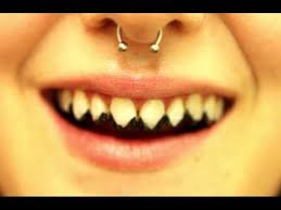 rotted teeth sharp pointed teeth