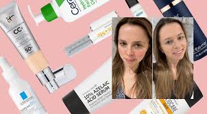 skin experts tackled our rosacea skin