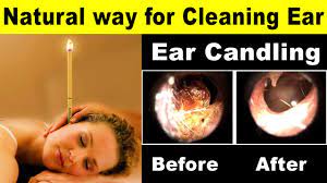 ear candling body sculpting pros and