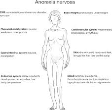 amenorrhea in eating disorders
