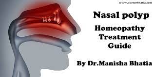 nasal polyps homeopathy treatment and
