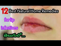 lip infection natural home remes