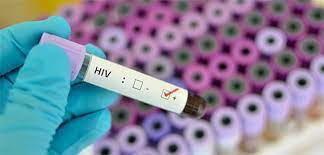 Aids test beim frauenarzt