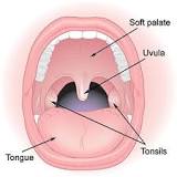 How painful is tonsil removal?