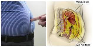 Nguyên nhân gây béo bụng ở phụ nữ - Các loại nước giúp giảm mỡ bụng