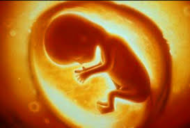 Image result for deprivation abortion