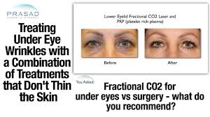 fractional co2 laser is a good wrinkle