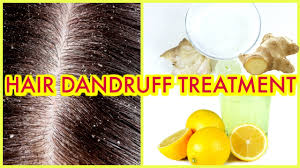 how to clear dandruff itchy scalp
