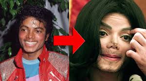 how did michael jackson turn white the