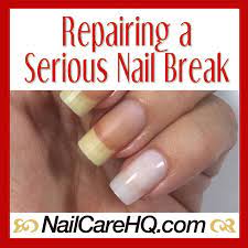 broken nail repair what to do when it