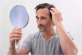 does low testosterone cause hair loss