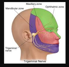 headaches and dizziness physiopedia