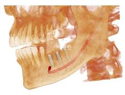 3d imaging cbct nidaan dental