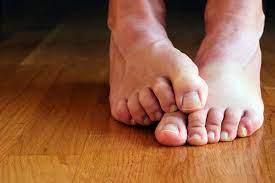 ew 8 ways to avoid stinky feet