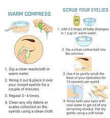 swollen eyelid what is it and how do