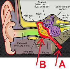 ear infections cal care one