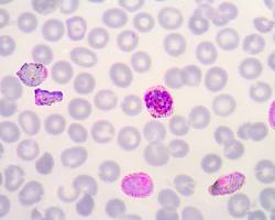 Malaria parasite Plasmodium in red blood cell