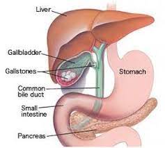 gallbladder surgery cholecystectomy