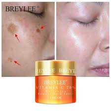 You may use it for dark spots, sun spots, age spots on your face, neck and body. Breylee Vitamin C Face Cream Whitening Facial Vc Freckles Remove Dark Spots Skin Brightening Cream Shopee Philippines