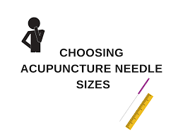 What Size Acupuncture Needles Should I Buy Phoenix