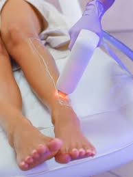 full body laser hair removal cost