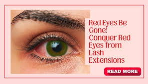 conquer red eyes after lash extensions