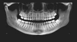 dental x ray test in delhi