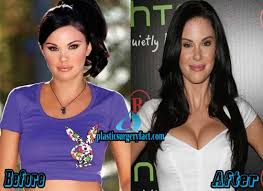 jayde nicole plastic surgery before and