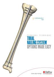 versanail tibial nailing system