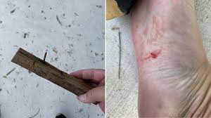 man steps on rusted nail in woodlands