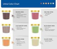 What color is your urine when your kidneys are failing?