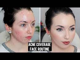 acne coverage pale skin makeup