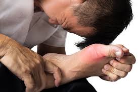 treating a stubbed toe fit feet for life