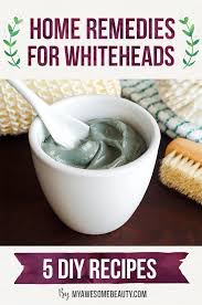 In this video we share 5 whiteheads on nose removal home remedies, an easy to formulate whiteheads removal hack nose solutions. How To Get Rid Of Whiteheads Fast And Safely On Face 7 Day Treatment