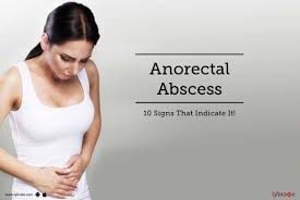 ayurvedic cines for anorectal and