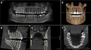 dental technology healthy roots dentistry
