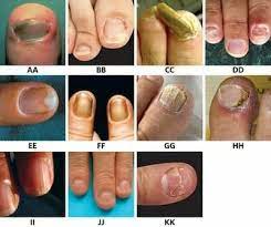 alphabetical repertory of nail