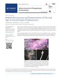 discoid lupus erythematosus