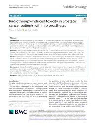 pdf radiotherapy induced toxicity in
