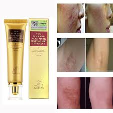 scar removal cream for old scars