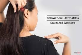 seborrheic dermais causes and
