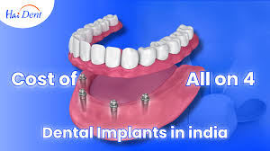 all on 4 dental implants in india cost