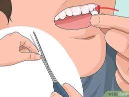 3.8 out of 5 stars. 5 Ways To Make Vampire Fangs Wikihow
