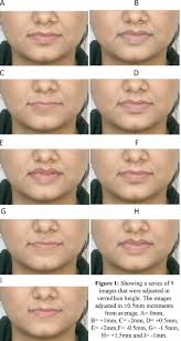 evaluation of lip esthetics by changing
