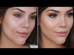 cover acne and pimples with makeup