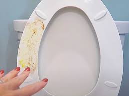 remove yellow stains from the toilet