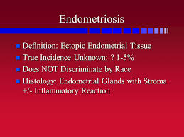 Disclaimer:all content and media on this channel is created and published only for informational & educational purposes. Endometriosis Definition In Urdu