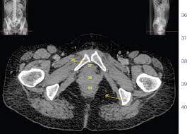 pelvis and abdomen radiology key