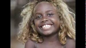 A black child with the most amazing blue eyes 1280x960. Black People With Blonde Red Hair And Blue Eyes 2013 O O Youtube